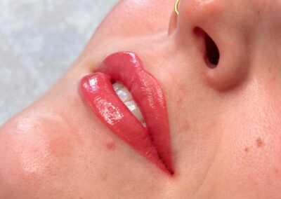 Lip pigmentatie