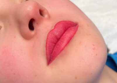 Lip pigmentatie